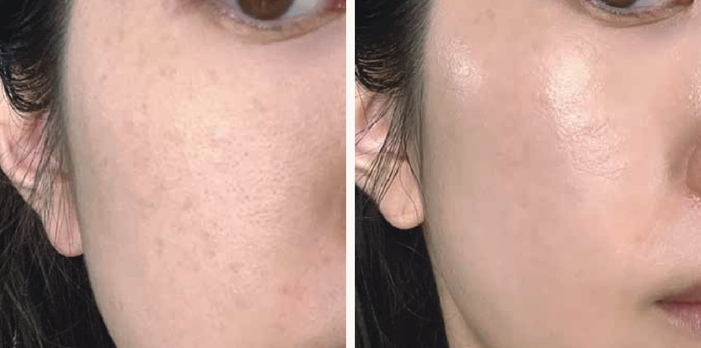 NOAV Spa Ampoule болон Booster Capsule хэрэглэсний өмнөх ба дараах үр дүн 6