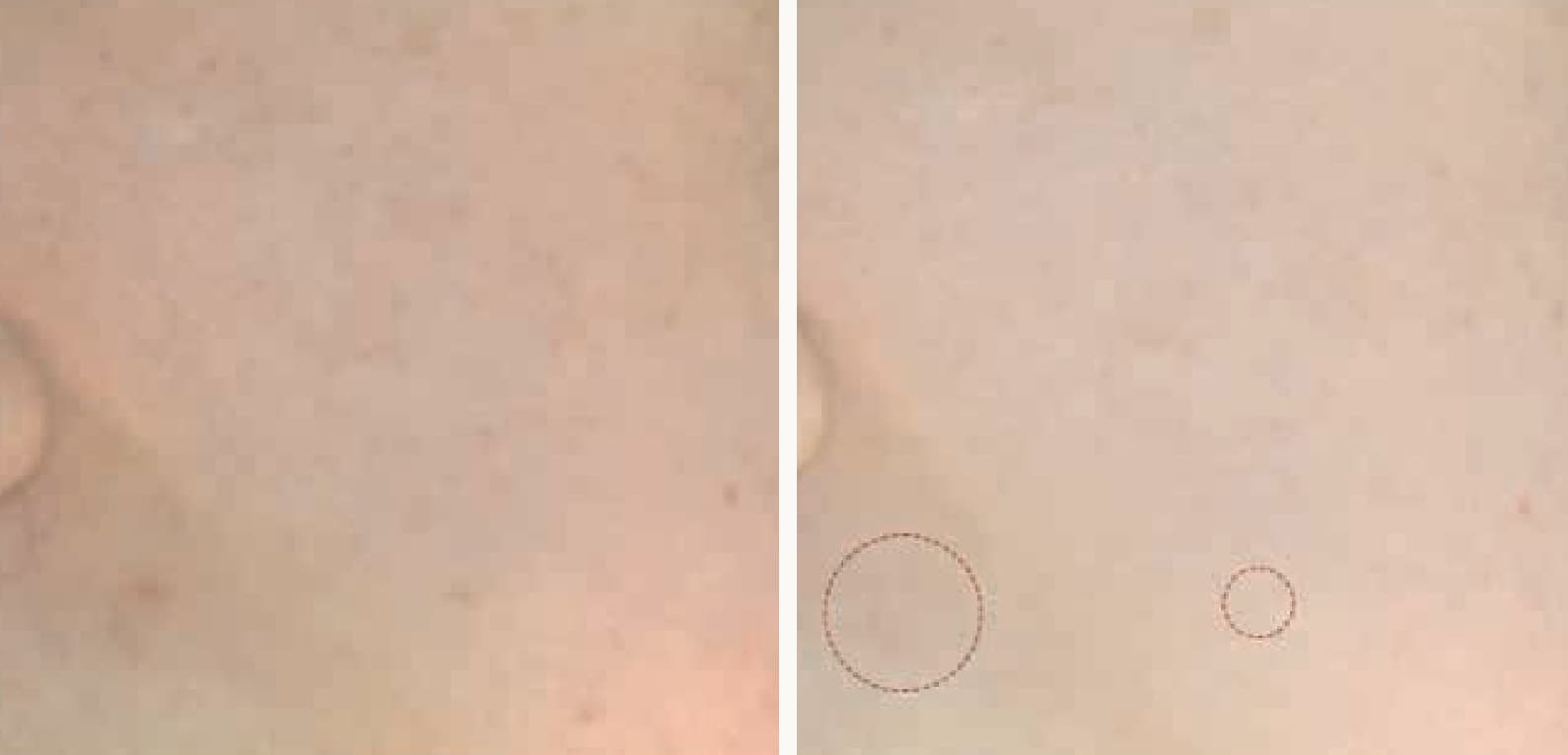 NOAV Real Vitamin Spa Capsule клиник харьцуулалт 2
